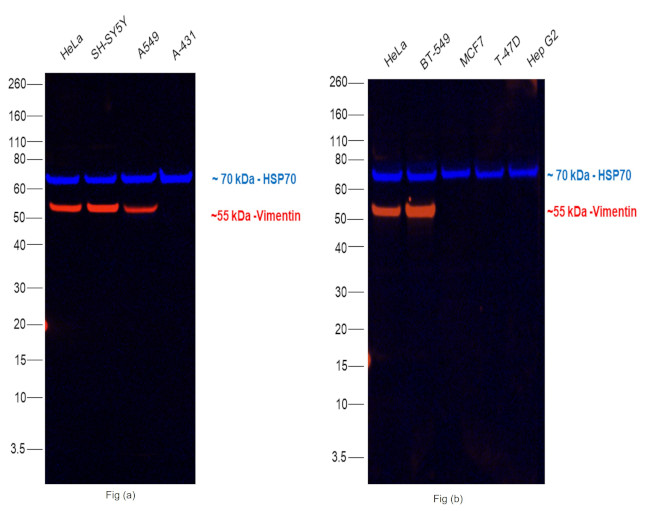 Vimentin Antibody