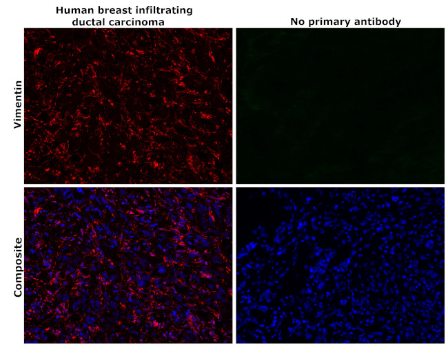 Vimentin Antibody in Immunohistochemistry (Paraffin) (IHC (P))