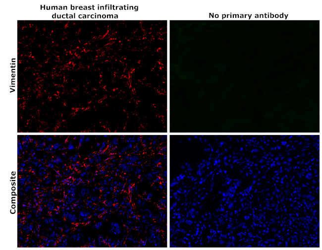 Vimentin Antibody in Immunohistochemistry (Paraffin) (IHC (P))