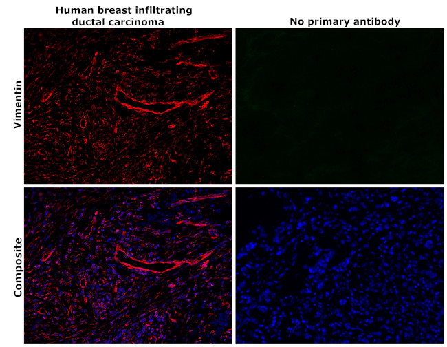 Vimentin Antibody in Immunohistochemistry (Paraffin) (IHC (P))