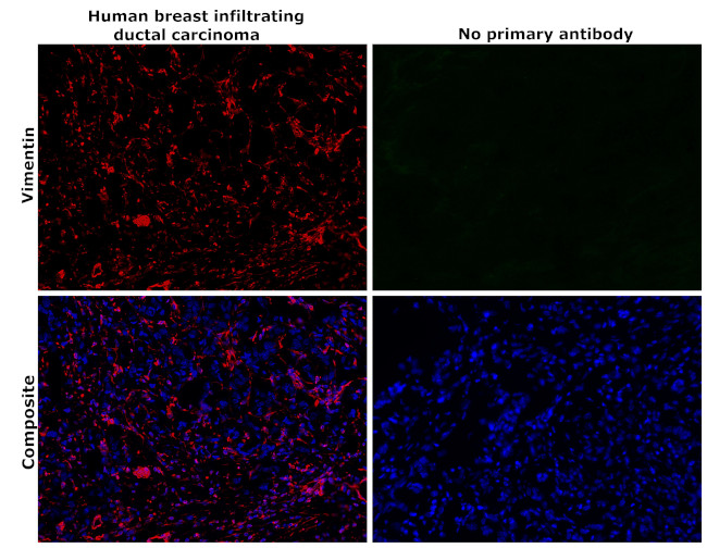 Vimentin Antibody in Immunohistochemistry (Paraffin) (IHC (P))