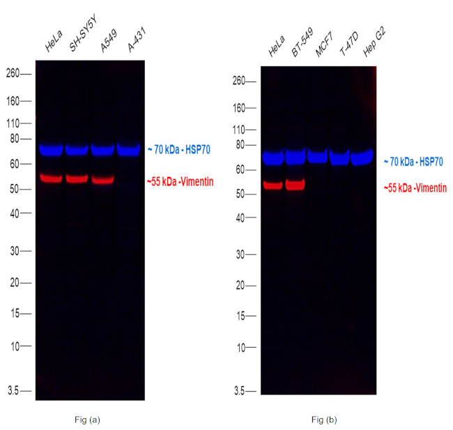 Vimentin Antibody