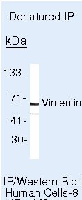 Vimentin Antibody in Immunoprecipitation (IP)