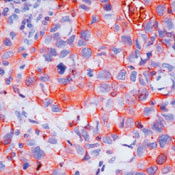 Prolactin Receptor Antibody in Immunohistochemistry (Paraffin) (IHC (P))