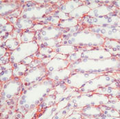 Fibronectin Antibody in Immunohistochemistry (Paraffin) (IHC (P))