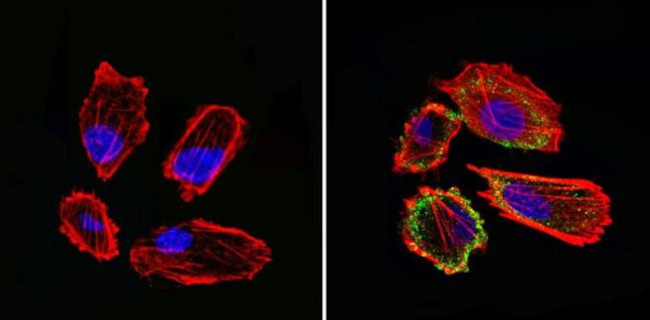 GFAP Antibody in Immunocytochemistry (ICC/IF)