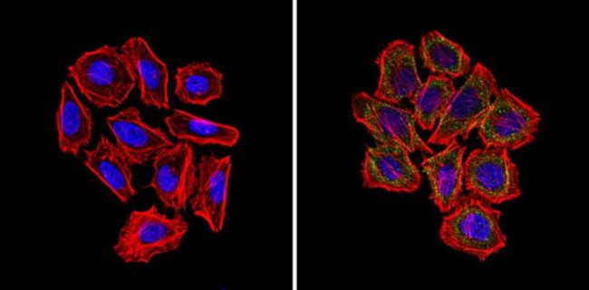 GFAP Antibody in Immunocytochemistry (ICC/IF)