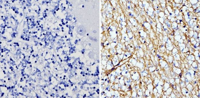 GFAP Antibody in Immunohistochemistry (Paraffin) (IHC (P))