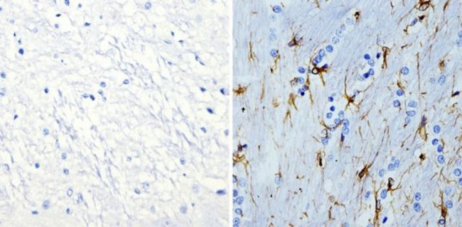 GFAP Antibody in Immunohistochemistry (Paraffin) (IHC (P))