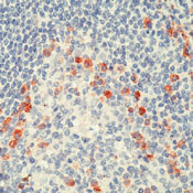 Human Kappa Light Chain Secondary Antibody in Immunohistochemistry (Paraffin) (IHC (P))