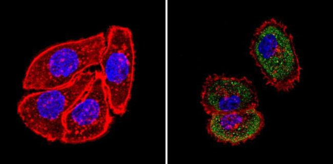 Cytokeratin HMW Antibody in Immunocytochemistry (ICC/IF)