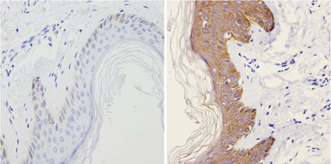 Cytokeratin HMW Antibody in Immunohistochemistry (Paraffin) (IHC (P))