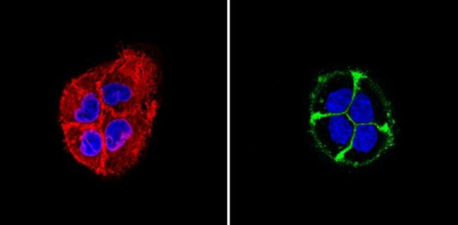 EpCAM Antibody in Immunocytochemistry (ICC/IF)