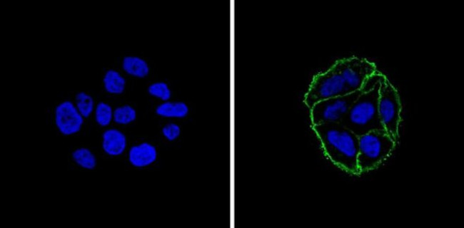 EpCAM Antibody in Immunocytochemistry (ICC/IF)