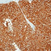 EpCAM Antibody in Immunohistochemistry (Paraffin) (IHC (P))