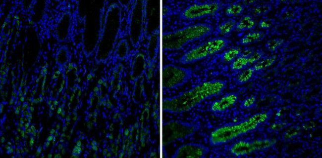 MUC5AC Antibody in Immunohistochemistry (Paraffin) (IHC (P))