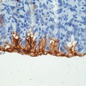 MUC5AC Antibody in Immunohistochemistry (Paraffin) (IHC (P))