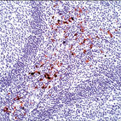 Calprotectin Antibody in Immunohistochemistry (Paraffin) (IHC (P))