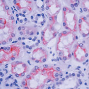 Villin Antibody in Immunohistochemistry (Paraffin) (IHC (P))