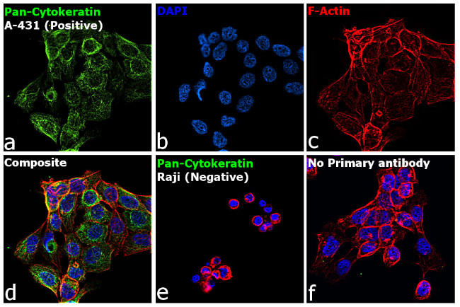 Cytokeratin Pan Antibody in Immunocytochemistry (ICC/IF)