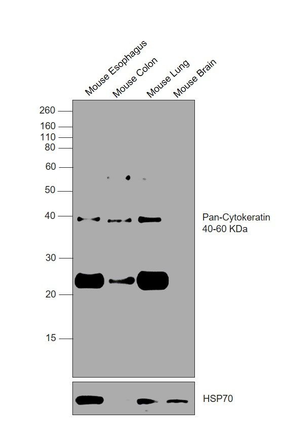 Cytokeratin Pan Antibody