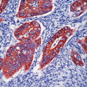 Cytokeratin Pan Antibody in Immunohistochemistry (Paraffin) (IHC (P))