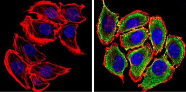 alpha Synuclein Antibody in Immunocytochemistry (ICC/IF)