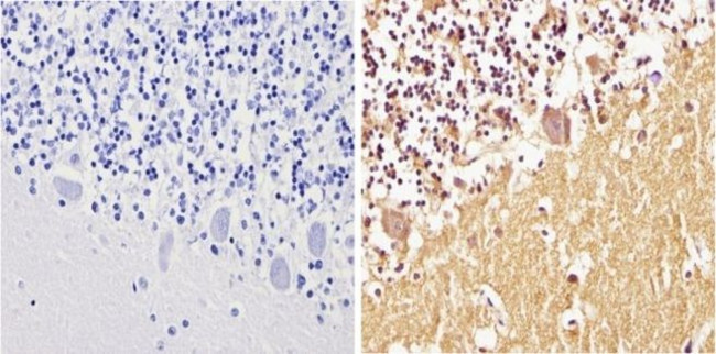 alpha Synuclein Antibody in Immunohistochemistry (Paraffin) (IHC (P))