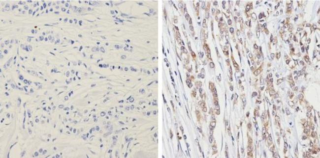 PTEN Antibody in Immunohistochemistry (Paraffin) (IHC (P))