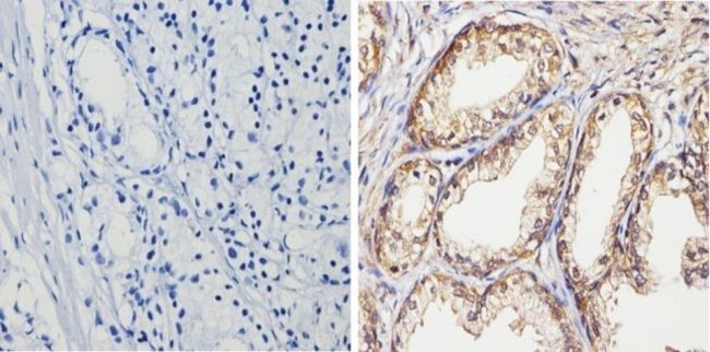 PTEN Antibody in Immunohistochemistry (Paraffin) (IHC (P))