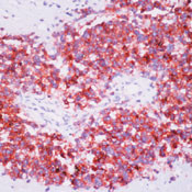 CD99 Antibody in Immunohistochemistry (Paraffin) (IHC (P))