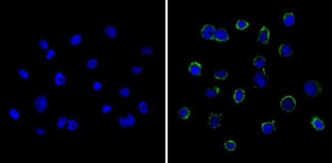 LCK Antibody in Immunocytochemistry (ICC/IF)