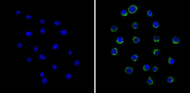 LCK Antibody in Immunocytochemistry (ICC/IF)