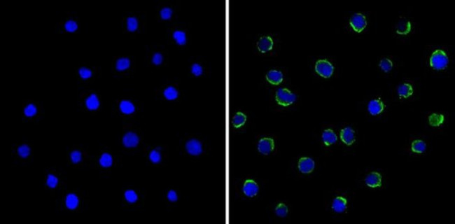 LCK Antibody in Immunocytochemistry (ICC/IF)