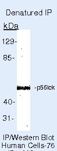 LCK Antibody in Immunoprecipitation (IP)