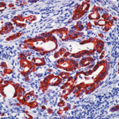 Cytokeratin 19 Antibody in Immunohistochemistry (Paraffin) (IHC (P))