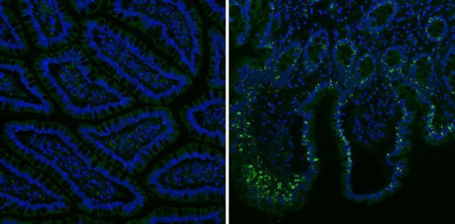 MUC2 Antibody in Immunohistochemistry (Paraffin) (IHC (P))