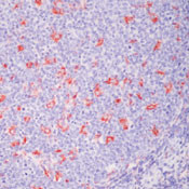 CD68 Antibody in Immunohistochemistry (Paraffin) (IHC (P))