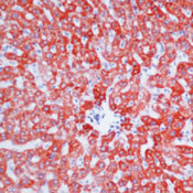 Hepatocytes Antibody in Immunohistochemistry (Paraffin) (IHC (P))