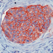 EpCAM Antibody in Immunohistochemistry (Paraffin) (IHC (P))