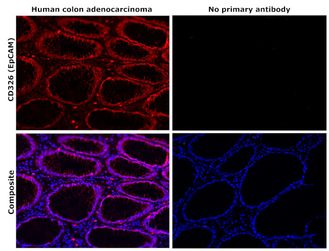 EpCAM Antibody in Immunohistochemistry (Paraffin) (IHC (P))