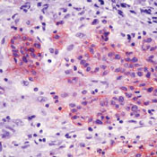 EpCAM Antibody in Immunohistochemistry (Paraffin) (IHC (P))