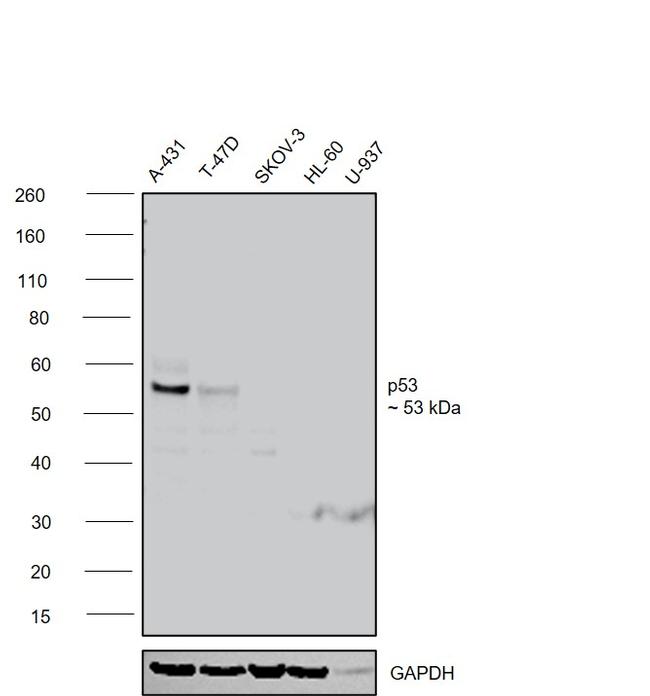 p53 Antibody in Western Blot (WB)