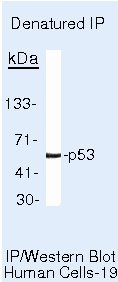 p53 Antibody in Immunoprecipitation (IP)