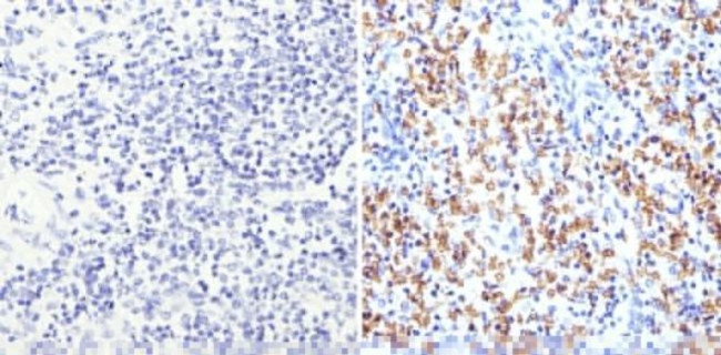 CD235a Antibody in Immunohistochemistry (Paraffin) (IHC (P))