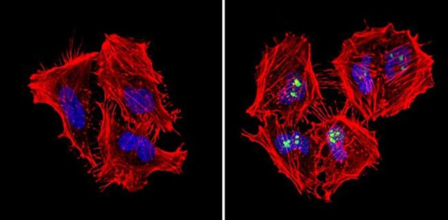 NPM1 Antibody in Immunocytochemistry (ICC/IF)