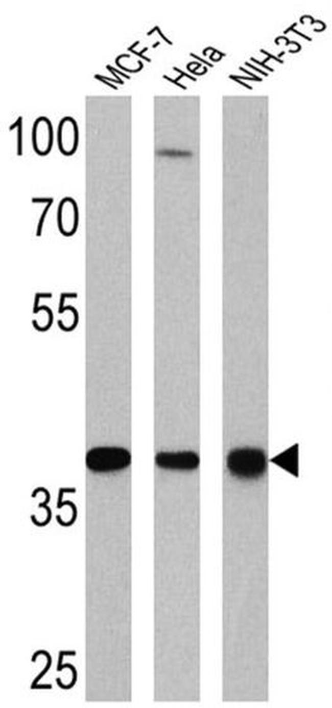 NPM1 Antibody in Western Blot (WB)