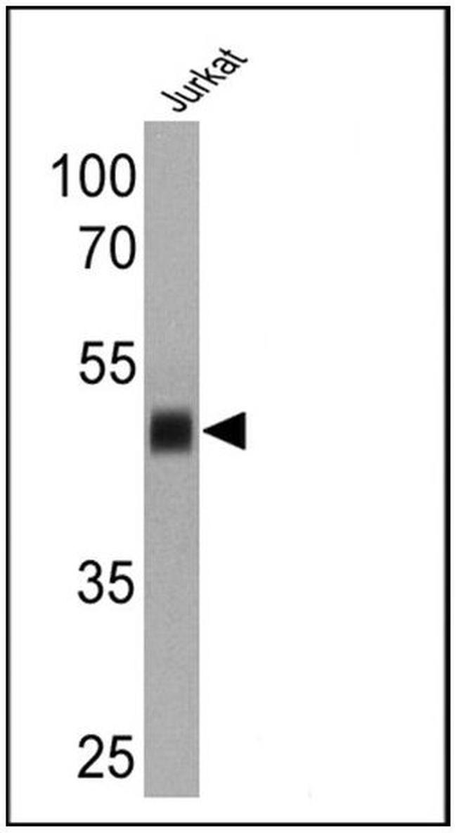 CD1a Antibody in Western Blot (WB)