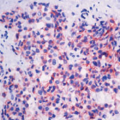 E-cadherin Antibody in Immunohistochemistry (Paraffin) (IHC (P))