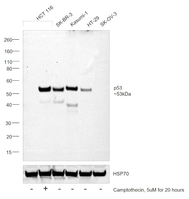 p53 Antibody in Western Blot (WB)